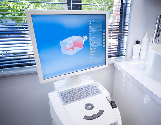 CEREC smile design on computer screen