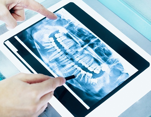 Digital dental x-rays on tablet computer