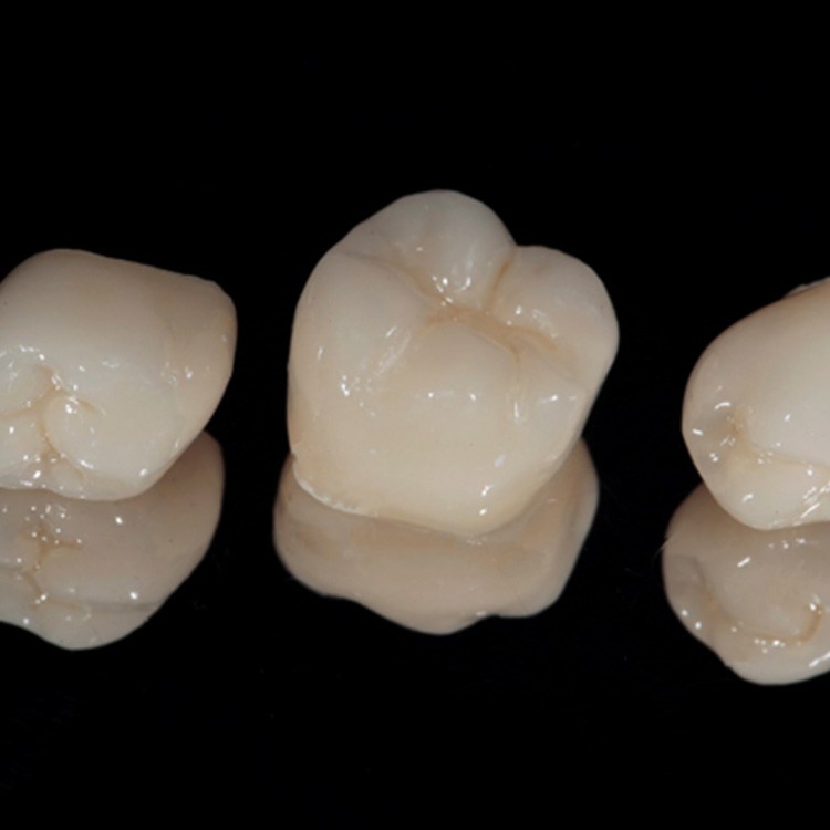Close-up of three CEREC dental crowns in Boerne, TX