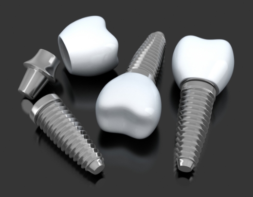 Three animated dental implants